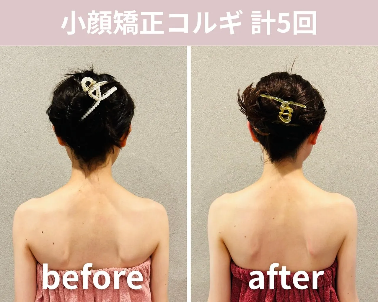 【小顔矯正コルギ】計5回の結果